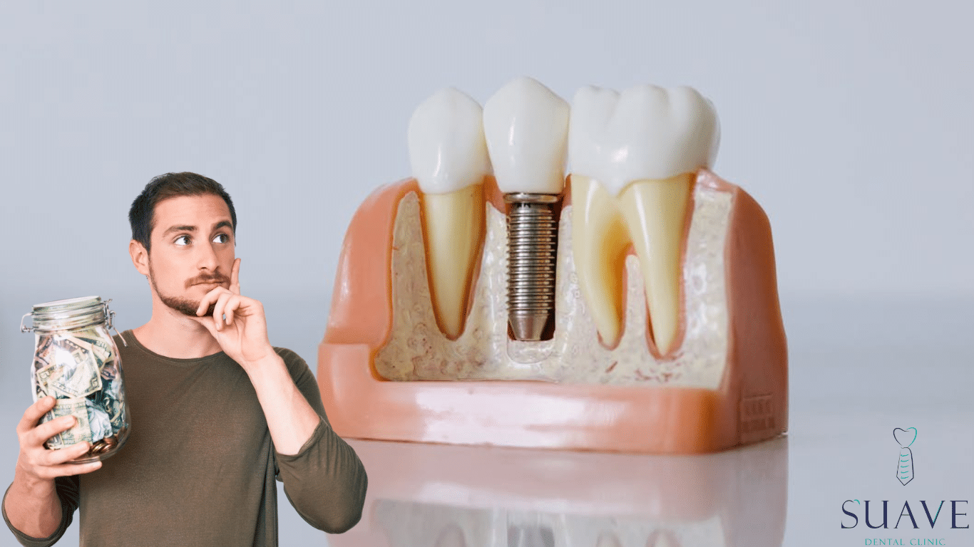 Cost of Full Mouth Dental Implants in Turkey - Suave Clinic
