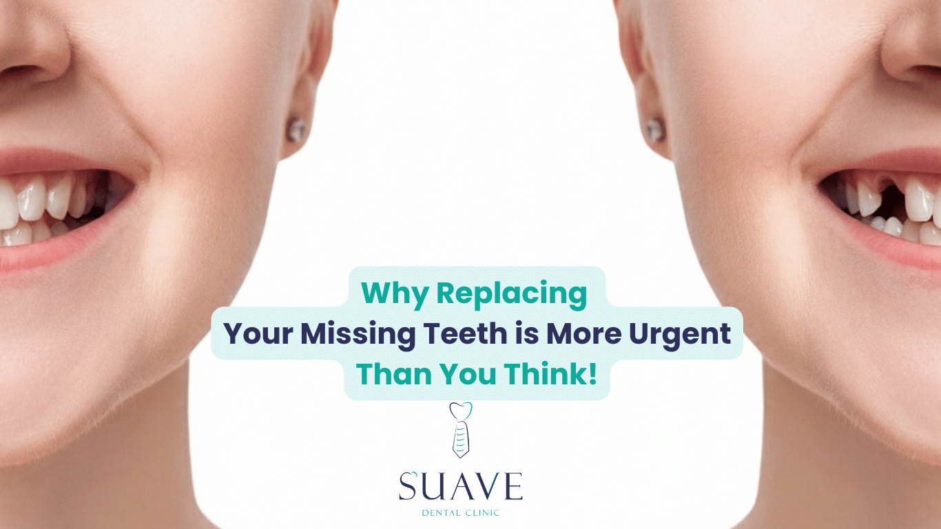 5 Reasons Why Replacing Missing Teeth is Urgent