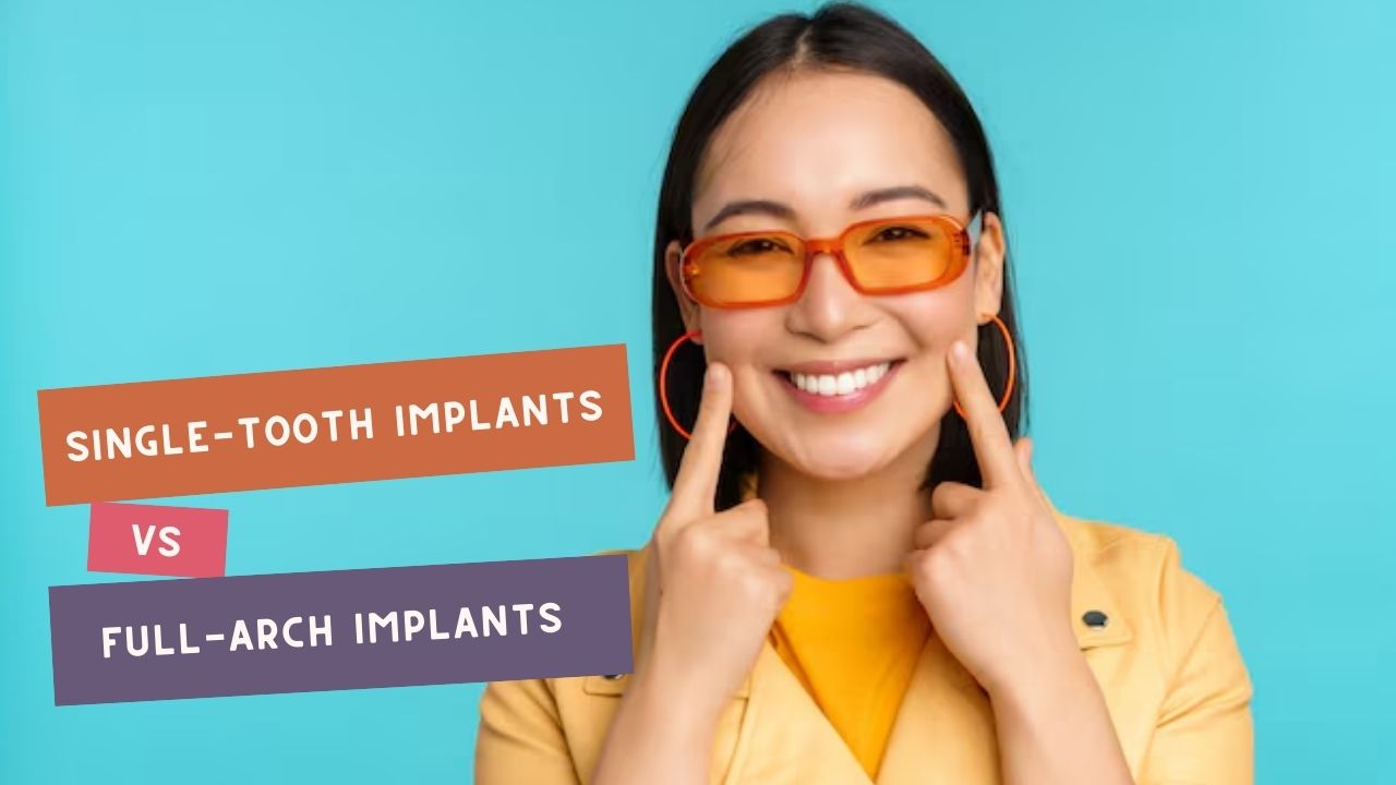 Guide to Single Tooth vs Full Arch Dental Implants in Kolkata
