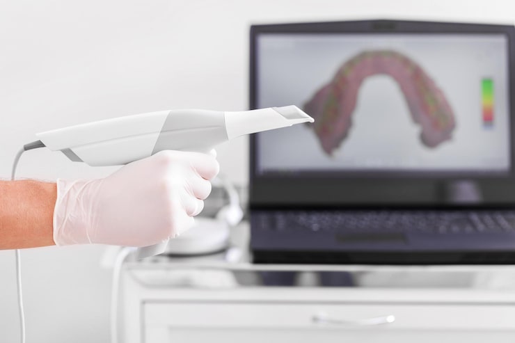 iTero Digital Dental Scans in Kolkata - Digital Dentistry in Kolkata