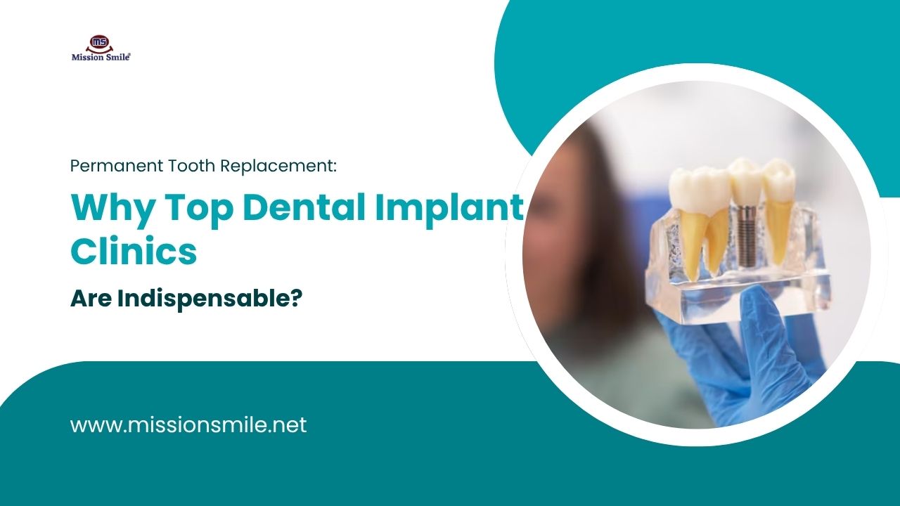 Why Top Dental Implant Clinics are Indispensable?